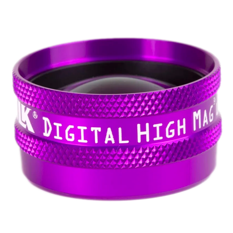Digital High Mag